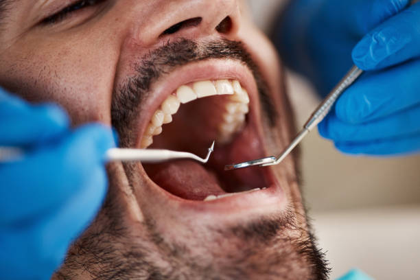 Best Urgent Tooth Repair  in Oak Grove, LA
