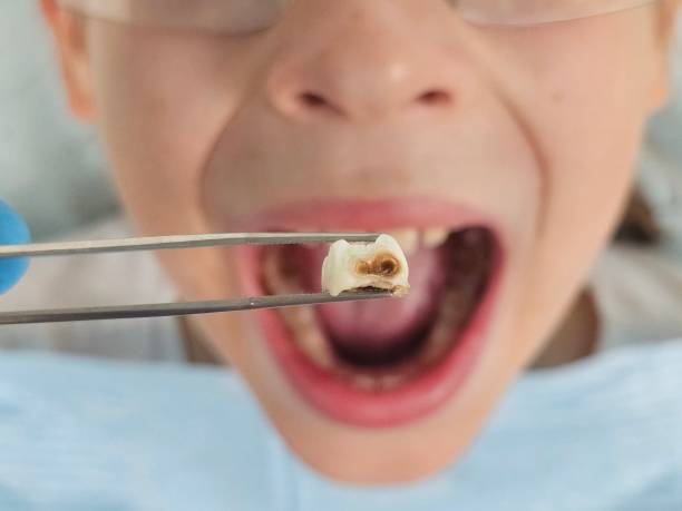 Best Emergency Dentist for Kids  in Oak Grove, LA